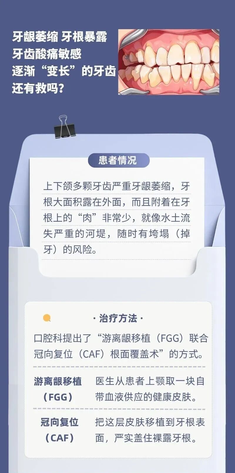 牙龈萎缩，牙齿「变长」还有救吗？