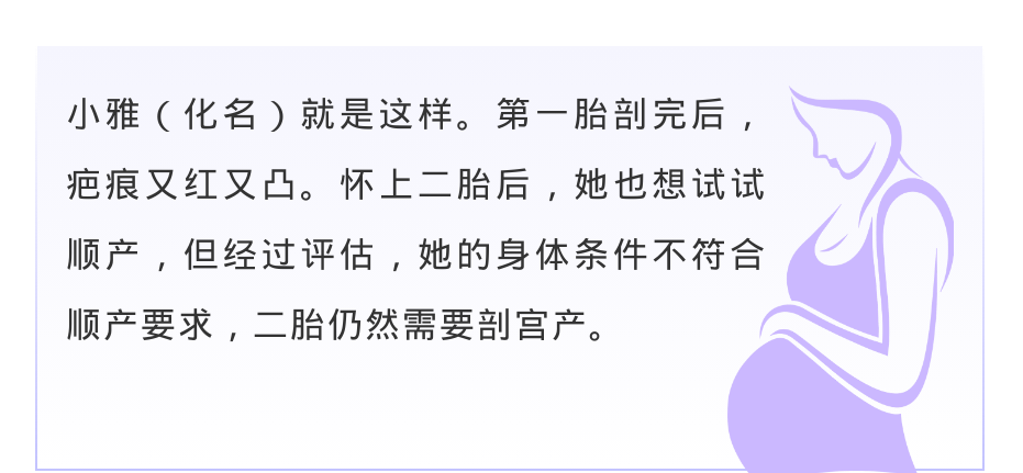 下腹部横切口 不是所有人都适合