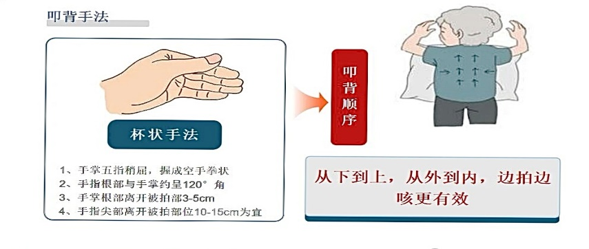 痰多咳不出？科学排痰全指南，让呼吸更顺畅