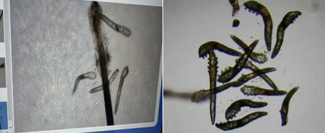 医路科普 | 眼睛越揉越痒,别乱治!睫毛根部的螨虫才是真凶