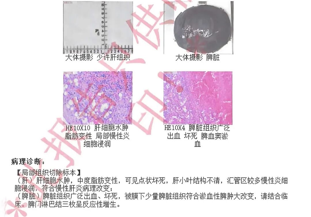 拳头大的器官长到 30 厘米!切下来能装一盆,医生都惊了