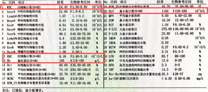 皮肤瘙痒 4 年,问题竟不在皮肤?结果是骨髓增殖性肿瘤