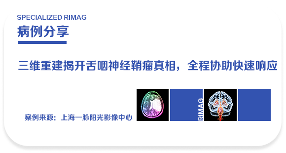 典型案例 | 一脉阳光三维重建揭开舌咽神经鞘瘤真相,全程协助快速衔接临床治疗