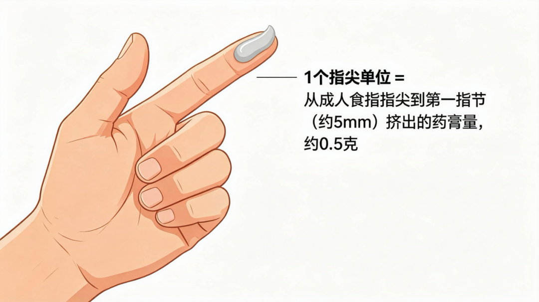 知药懂用 | 拒绝盲目止痒!过敏季,激素药膏使用避坑指南