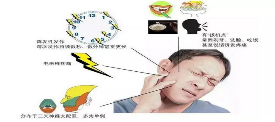 三叉神经痛不用硬扛!一根细针,半小时微创手术解除数年剧痛!