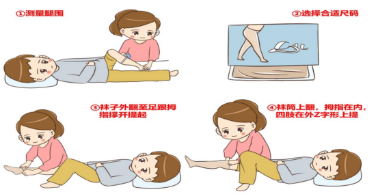 脑卒中后下肢静脉血栓的预防