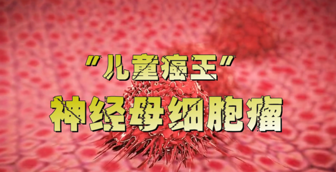 警惕 「儿童癌症之王」 ——神经母细胞瘤
