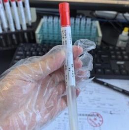 【燕医科普】燕达医院病理科：浅谈女性阴道分泌物检测的重要性