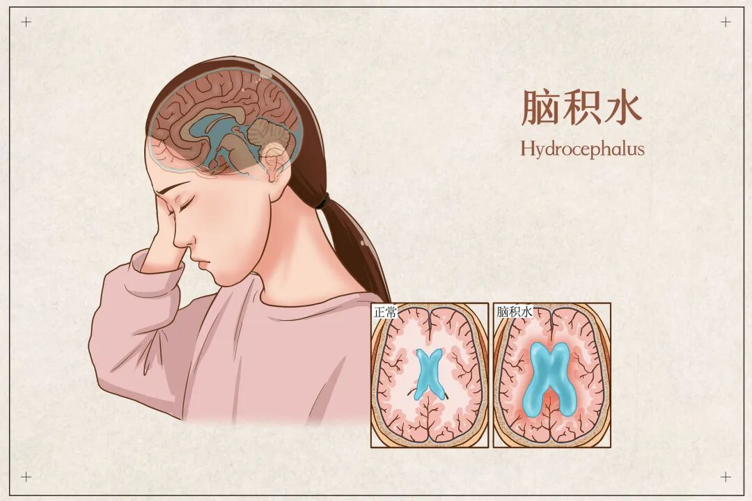 少年一觉沉睡唤不醒,竟是十年旧疾突发危机!