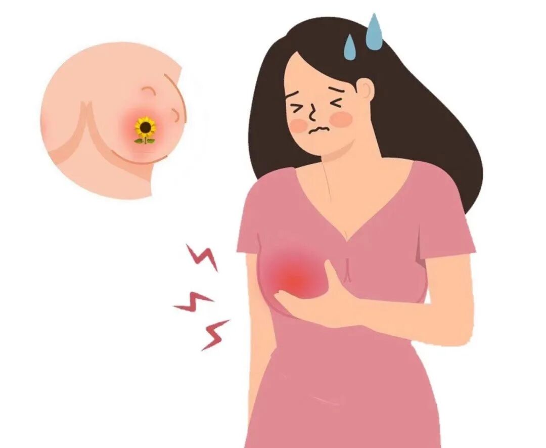 哺乳期有多难?稍有忽视,乳房切开引流