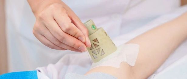 网球肘、妈妈手... 这种筋伤，有解