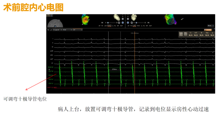 病例会说话 | 心跳 200 次/分的生死一周:我院多学科「接力」拯救 22 岁年轻孕妇
