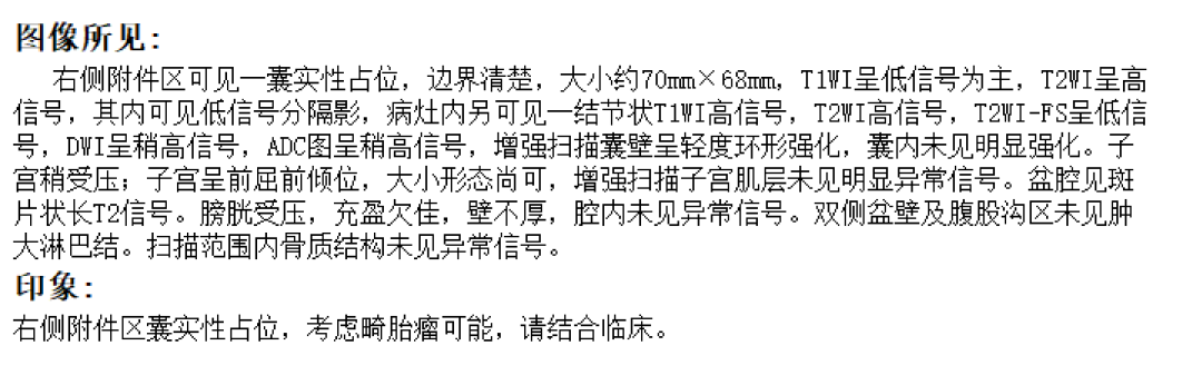 【高尚病例】卵巢畸胎瘤