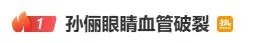 孙俪演戏太投入,竟把眼睛「气」出血?别慌!这种吓人的「兔子眼」,比熬夜还常见