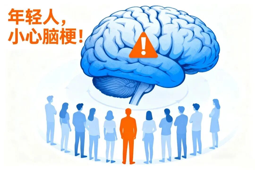 颈部「墙壁」撕裂，大脑瞬间缺血！这个隐藏的脑梗病因，年轻人尤其要警惕！