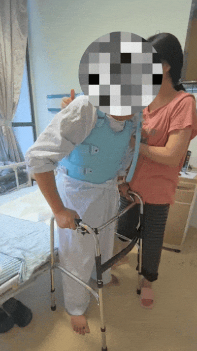 18 年无法抬头！100° 重度驼背的「折叠人」，在这里重新挺直脊梁