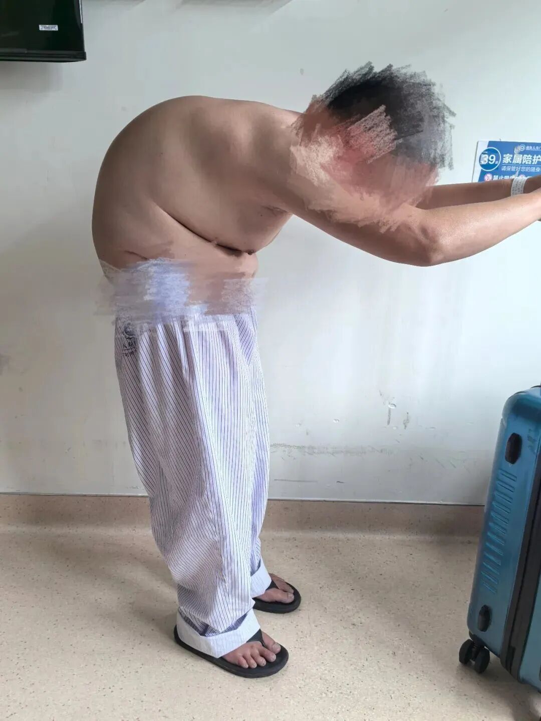 18 年无法抬头！100° 重度驼背的「折叠人」，在这里重新挺直脊梁