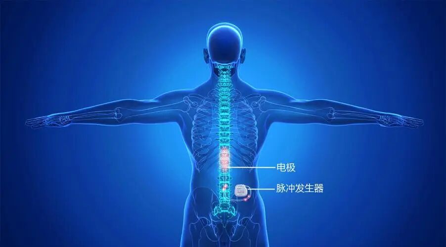 深昏迷 2 个月后,「植物人」醒了!