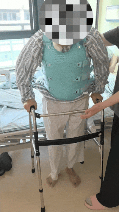18 年无法抬头！100° 重度驼背的「折叠人」，在这里重新挺直脊梁