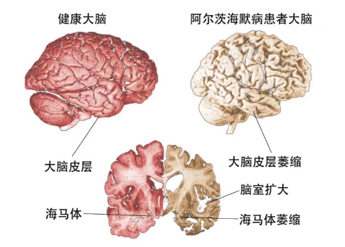 爆哭电影《给阿嬷的情书》背后：遗忘之前，她曾用一生去爱