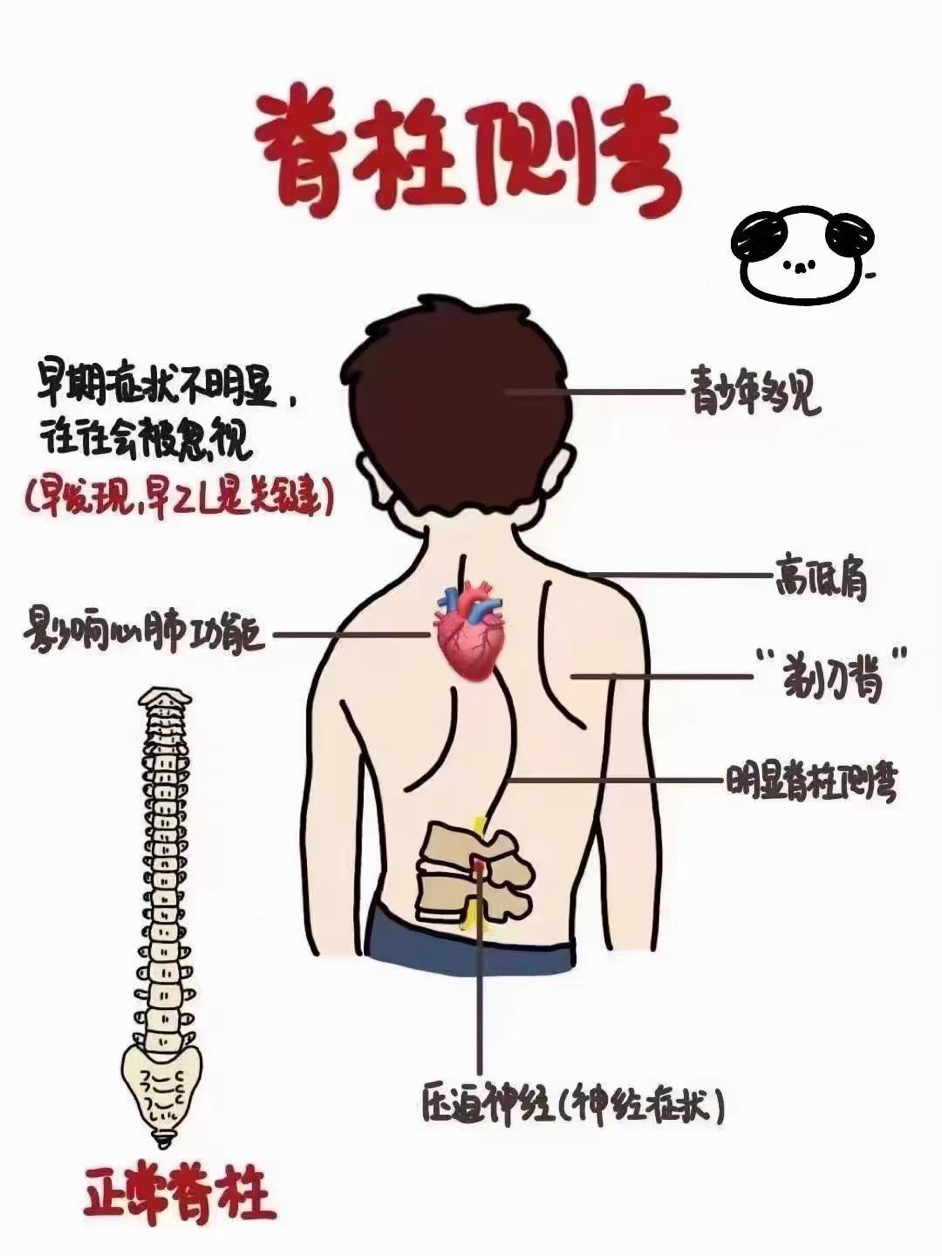 【二附院医生说】守护挺拔身姿，每个家长都该知道的脊柱健康秘密