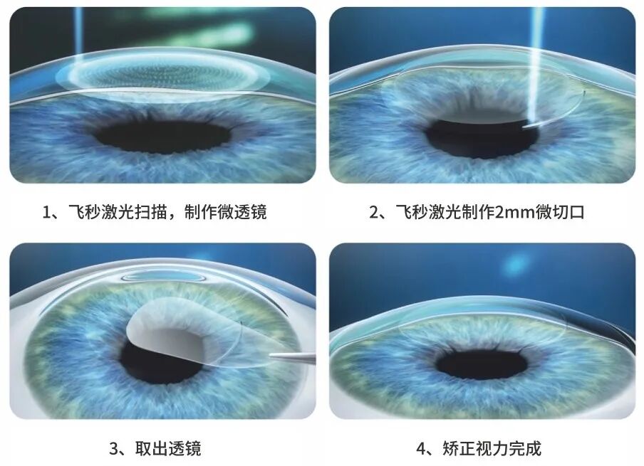 【健康科普】高考后想报这些专业?先看看你的视力达标了吗?