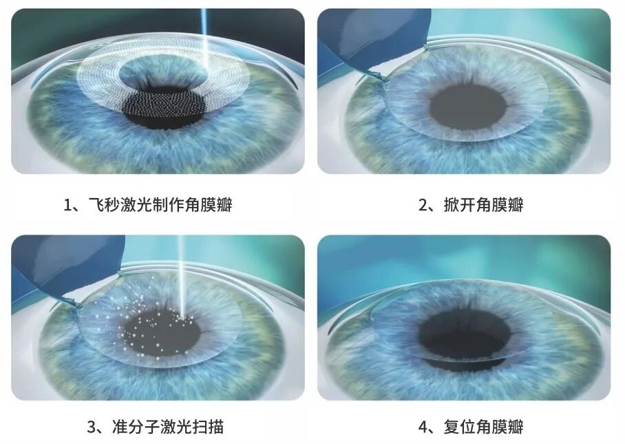 【健康科普】高考后想报这些专业?先看看你的视力达标了吗?