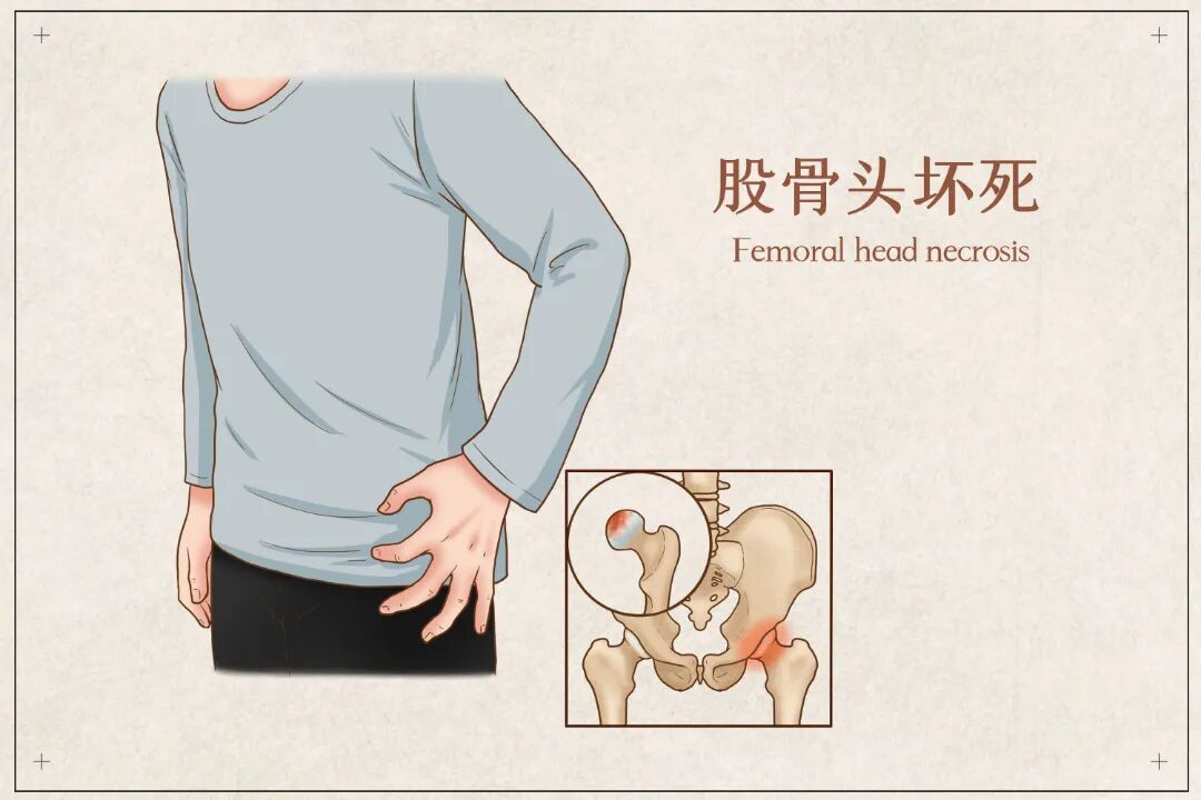 三重疾病叠加,南医大二附院多学科协作让患者重获行走能力
