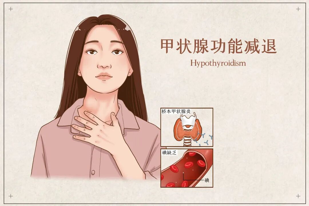 结节两年不理,最终双肺转移!结节风险、超声分级、孕期标准,一文看懂