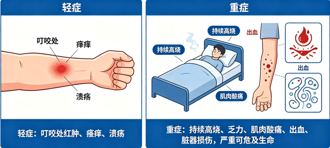 高烧不退,医生在他身上发现 17 颗「小黑点」!医生提醒:被咬后千万别硬拔