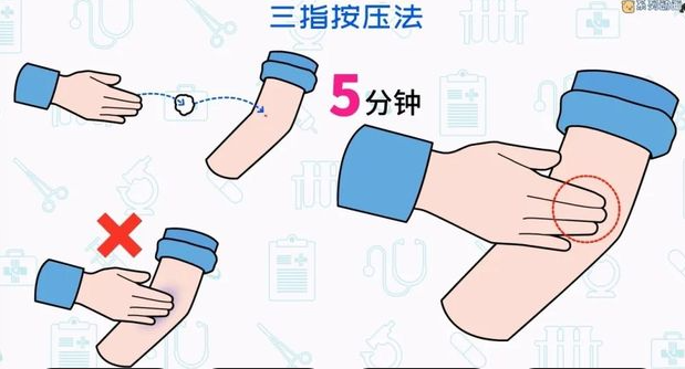 医语辟谣｜抽血后手臂淤青？是医生技术不过关？