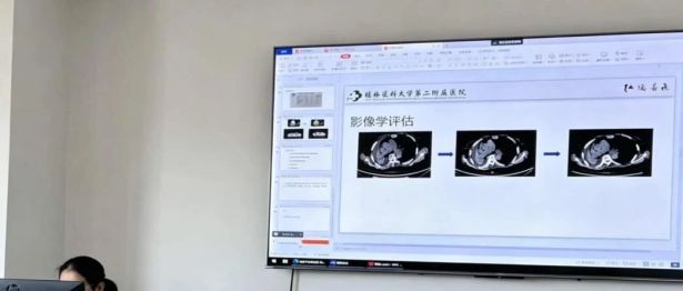打破地域壁垒 | 二附院联合中山大学肿瘤防治中心专家开展诊疗会诊