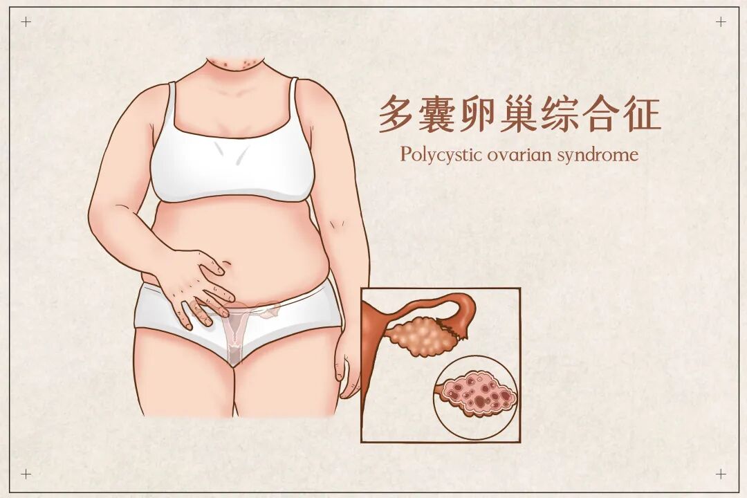 面相变了,皮肤粗了,好好的娃得了这种病,家长后悔不已