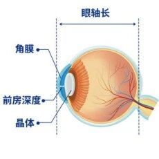 2026 高考军警摘镜必读：视力门槛+手术倒计时