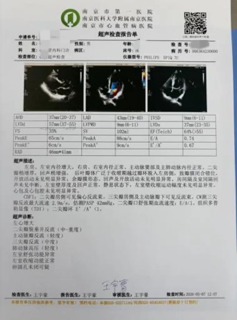 【微创「心」突破】精准视野 免于换瓣——淮安市一院再次成功开展达芬奇机器人二尖瓣修复术