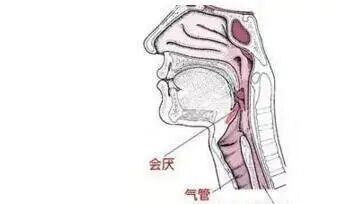 嗓子总是不舒服?可能是会厌囊肿在「捣乱」