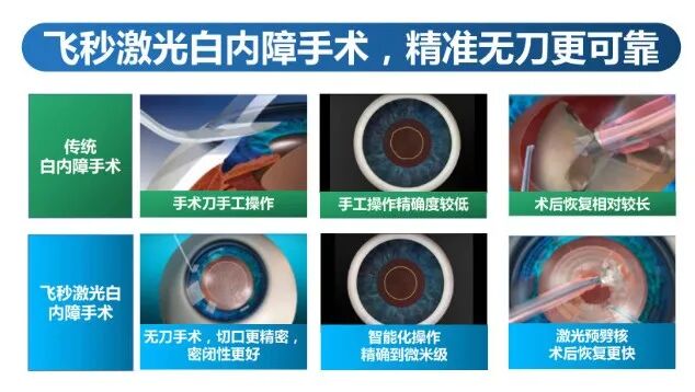 从「看得见」到「看得清、看得好」，为什么越来越多的人选择飞秒激光白内障手术？