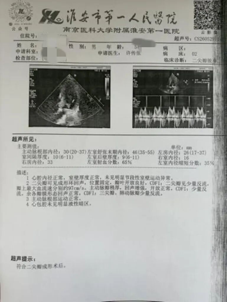 【微创「心」突破】精准视野 免于换瓣——淮安市一院再次成功开展达芬奇机器人二尖瓣修复术
