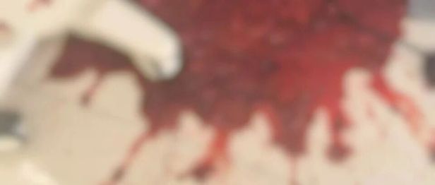 生死博弈！呕血超全身一半血量，多学科协作创造生命奇迹