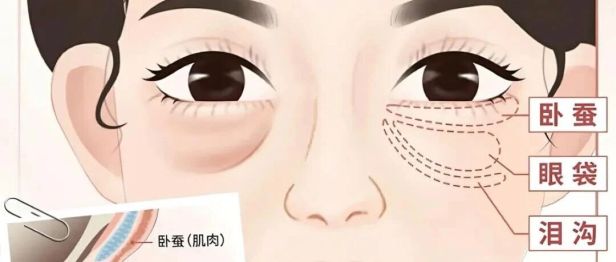 【医路有知】告别眼袋，科学认识「疲惫眼」