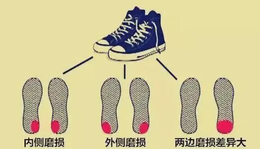 这 6 种不起眼的小「毛病」,可能是疾病信号!别不当回事!