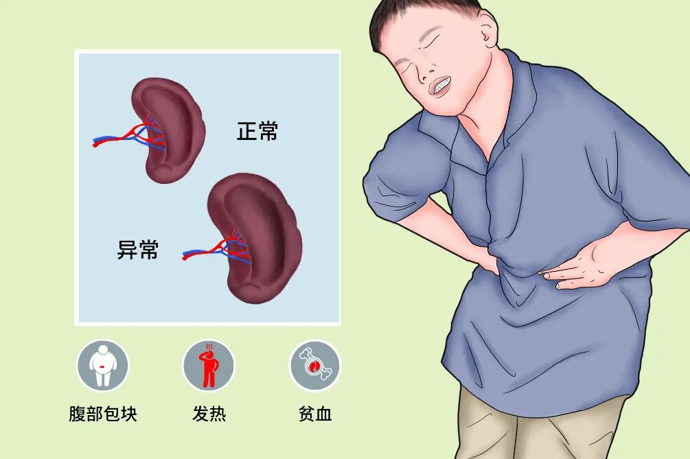 女子深夜腹痛险送命,脾脏碎成豆腐渣!元凶竟是网红「瘦腰神器」
