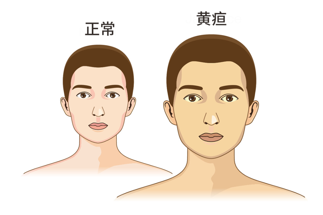 这 6 种不起眼的小「毛病」,可能是疾病信号!别不当回事!