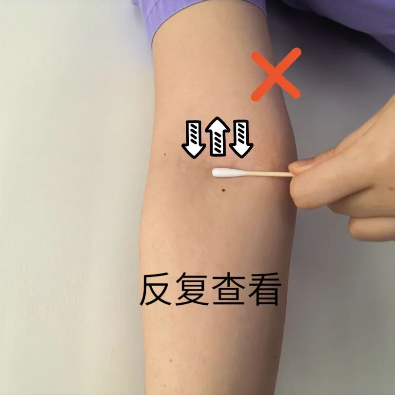 输液后淤青别慌！--这份「黄金按压法」请收好