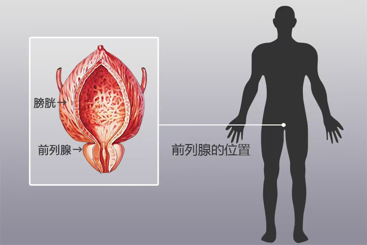 检验科普:前列腺液常规检查