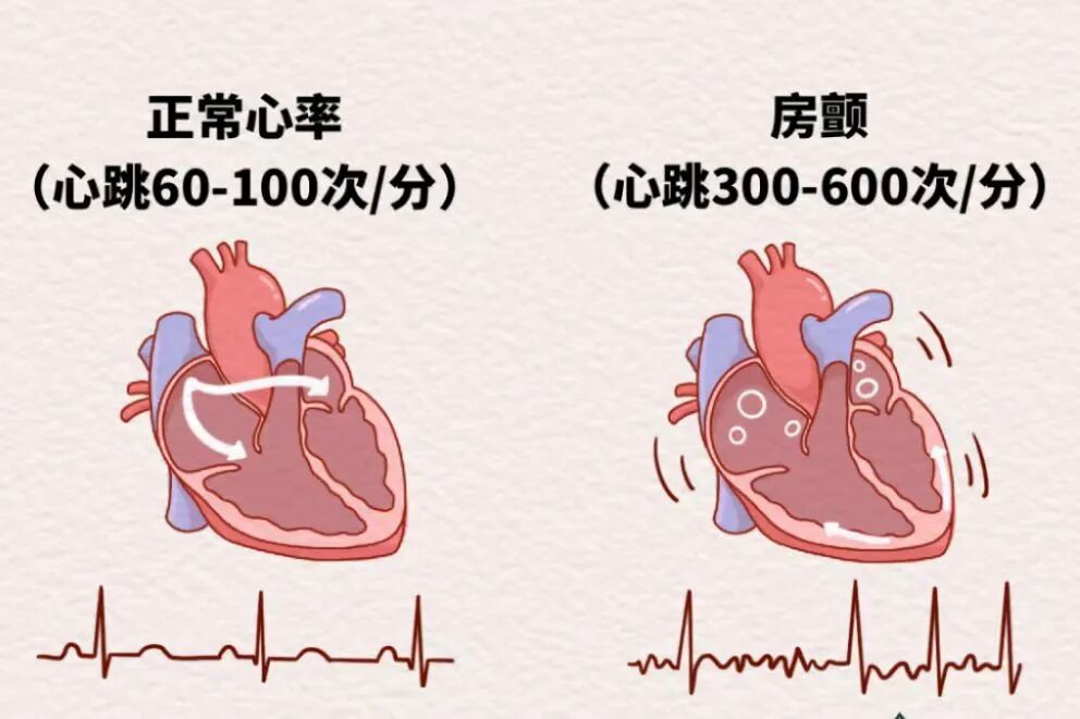 你是否有心跳乱了的时候?(不是一见钟情