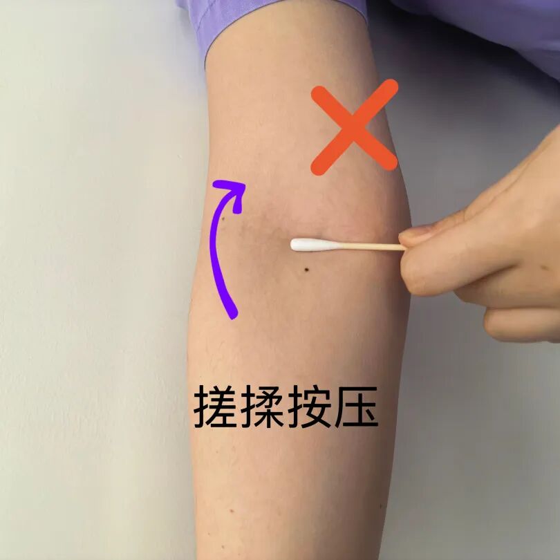 输液后淤青别慌！--这份「黄金按压法」请收好