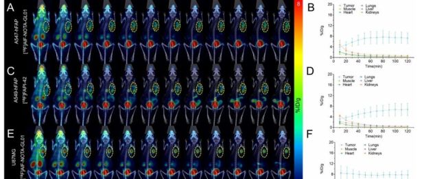 桂林医科大学一附院核医学科团队在新型肿瘤 PET 分子探针研究中取得新进展