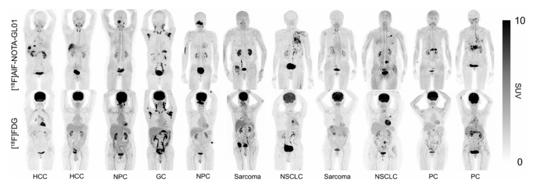 桂林医科大学一附院核医学科团队在新型肿瘤 PET 分子探针研究中取得新进展