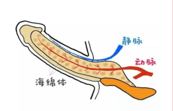 10年糖尿病引发重度器质性功能障碍，我院男科精准手术助力患者康复